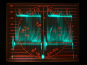 Bad Waveform